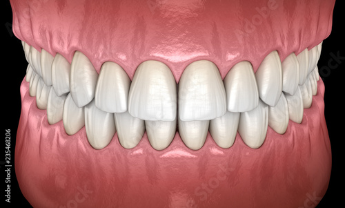 Fototapeta Naklejka Na Ścianę i Meble -  Healthy human teeth with normal occlusion frontal view. Medically accurate tooth 3D illustration