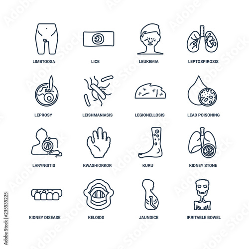 Irritable bowel syndrome, Jaundice, Keloids, Kidney Disease (Chr