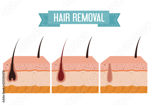 layers skin structure with hair removal icons