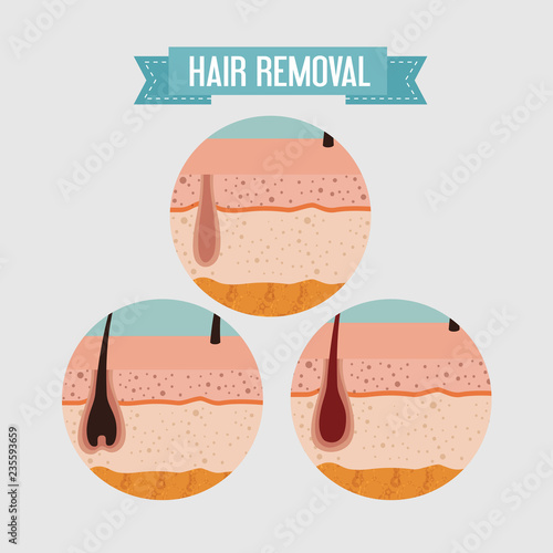 layers skin structure with hair removal icons