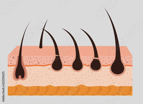 layers skin structure with hair removal icons
