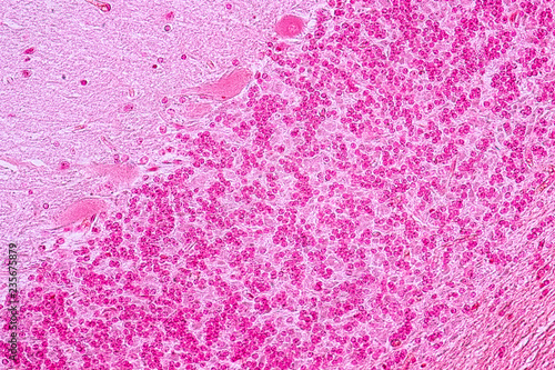 Cross section of the Cerebellum and Nerve human under the microscope for education in Lab.