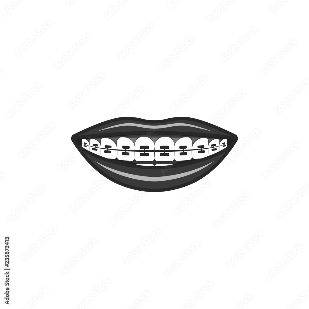 Dental braces dental illustration in black and white, human smile with a device for leveling the bite Dental braces dental illustration in black and white, human smile with a device for leveling the bite