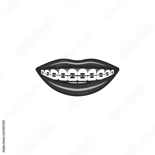 Dental braces dental illustration in black and white, human smile with a device for leveling the bite