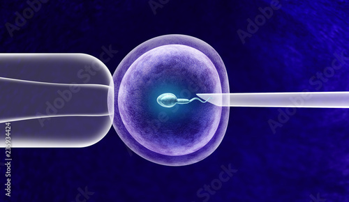 In Vitro Fertilization photo