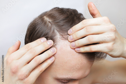 a man is checking his hair for loss. hair loss