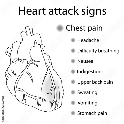 Heart attack signs, symptoms. Myocardial infarction. Damaged heart muscle. Medical, anatomical flat outline illustration.