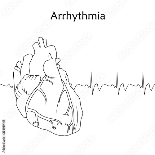 Human heart. Arrhythmia. Anatomy flat illustration. Outline image, white background. Heartbeat, pulse.