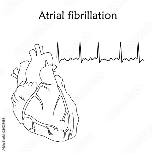 Human heart. Atrial fibrillation. Anatomy flat illustration. Outline image, white background. Heartbeat, pulse.
