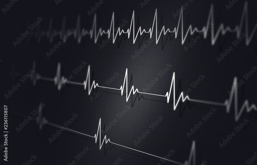 Different Heart beats Illustration Different Heart beats Illustration