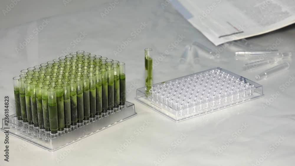 Laboratory of enzyme analysis. Diagnosis of viral infection in plant