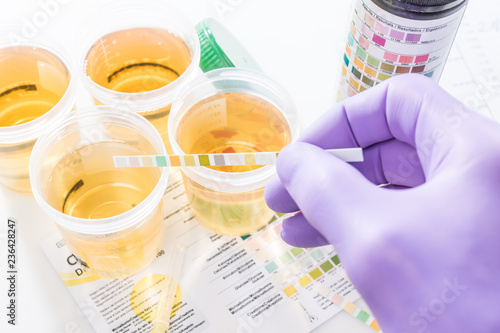Картината върху платно urine test strips in purple gloves