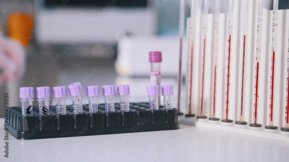 Medical clinic. Nurse put a stand with test tubes near the pipettes filled up with blood Medical clinic. Nurse put a stand with test tubes near the pipettes filled up with blood