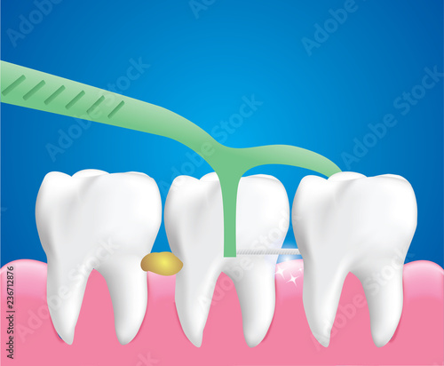Dental Floss Picks, Dental Cleaning Tool, Dental care concept, Illustration Vector