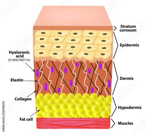 Anatomical structure of the skin. Elastin, Hyaluronic acid, Collagen. Infographics. causes of wrinkles on the skin. Vector illustration on isolated background.