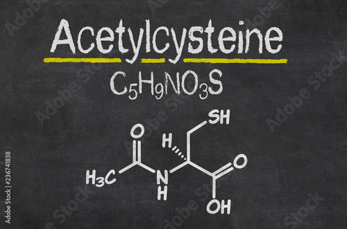 Blackboard with the chemical formula of Acetylcysteine