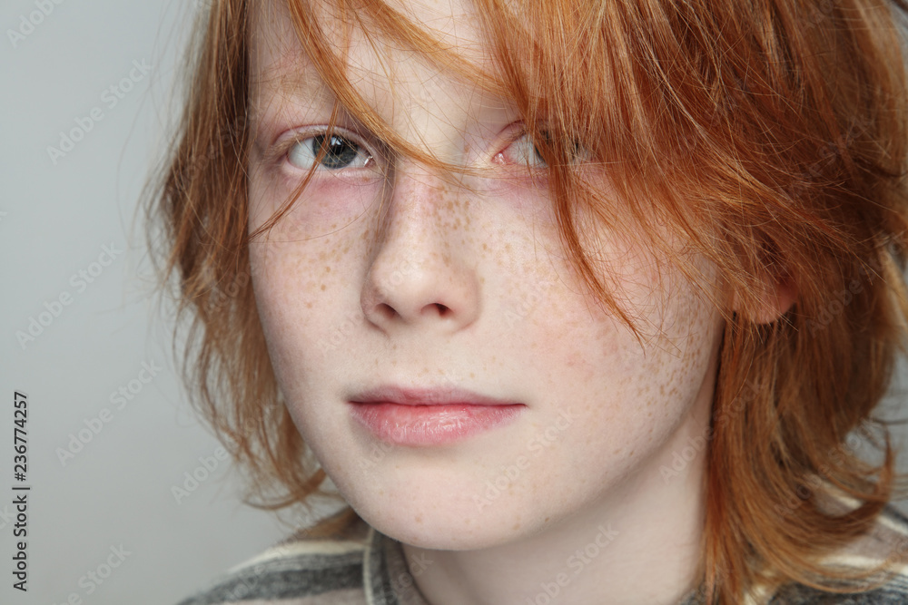 Portrait of handsome redhead teen boy with freckles
