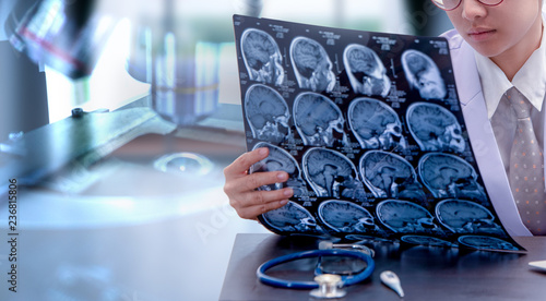 young female doctor holding MRI or CT scan picture photo