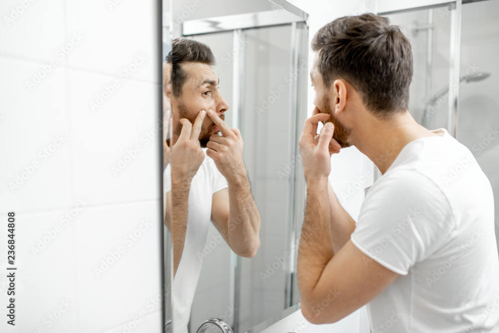 Man in white t-shirt squeezing acne on his face looking to the mirror in the bathroom Man in white t-shirt squeezing acne on his face looking to the mirror in the bathroom