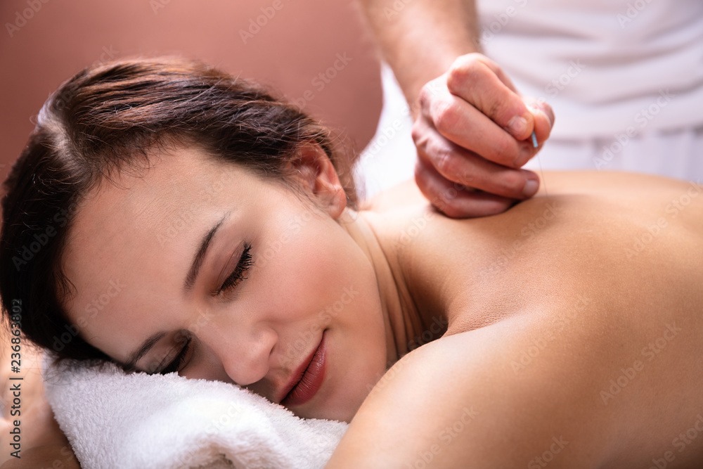 Woman Going Through Acupuncture Treatment - obrazy, fototapety, plakaty 