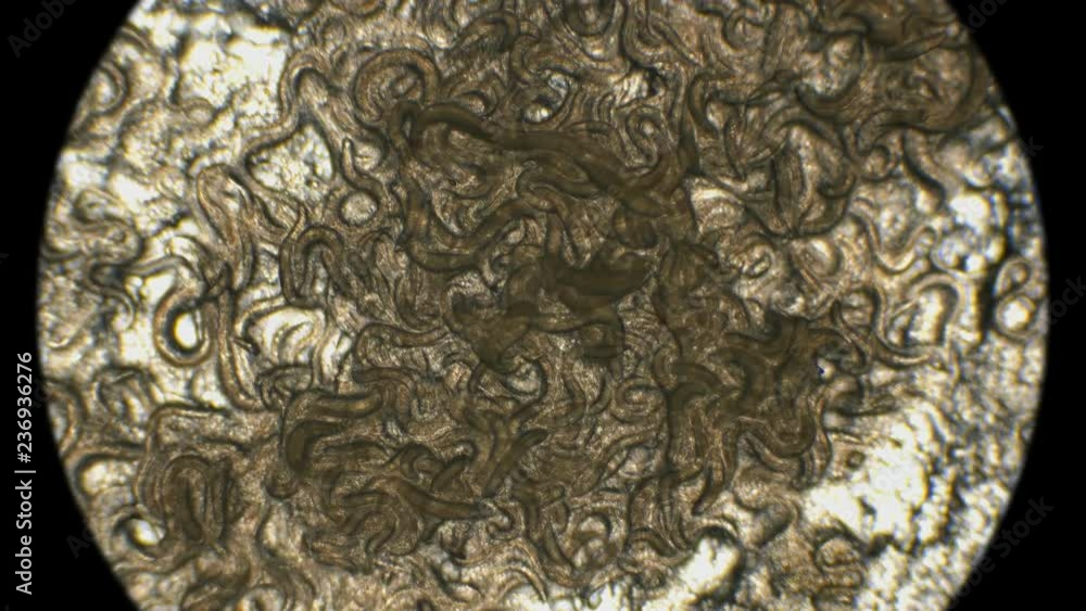 Nematode Worm Colony Which Is Used To Feed Fish Fry Under A nematode-worm-colony-which-is-used-to-feed-fish-fry-under-a