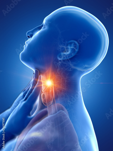 3d rendered medically accurate illustration of a man having a sore throat