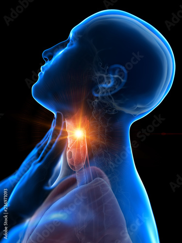 Foto 3d rendered medically accurate illustration of a man having a sore throat