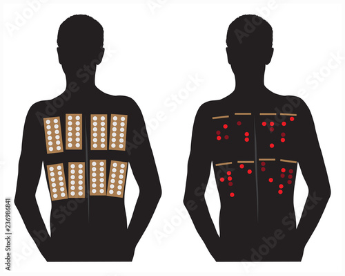 Allergy patch skin tests vector illustration