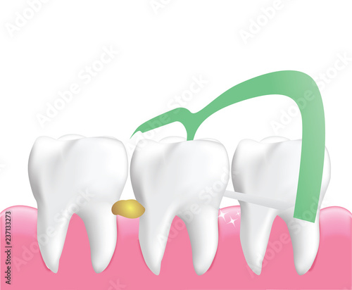Dental Floss Picks, Dental Cleaning Tool isolated on white background, Realistic design illustration Vector.