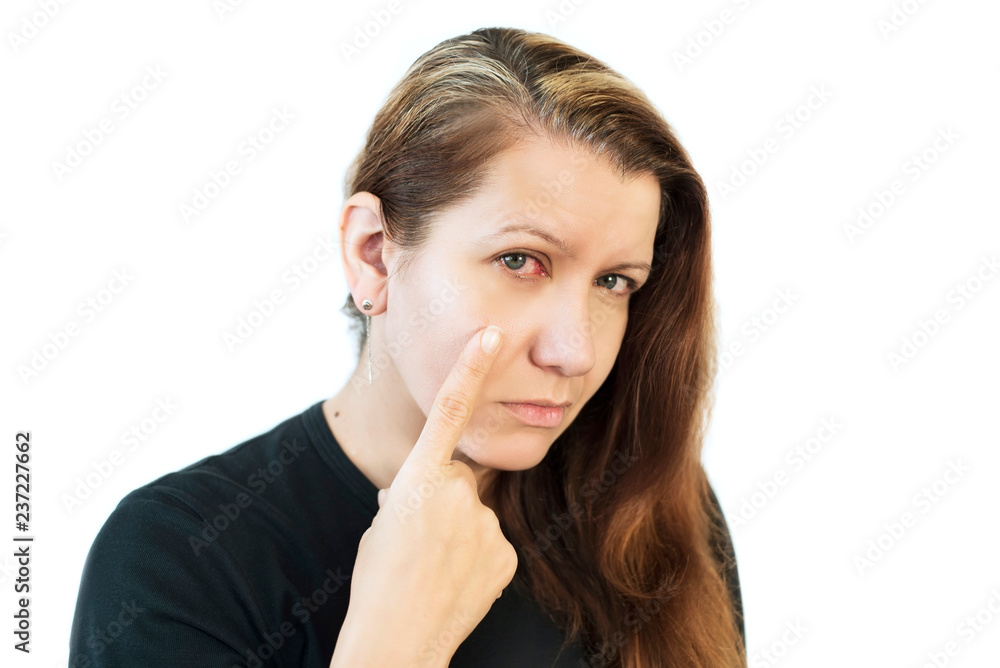 A sad middle-aged woman on a white background points her finger to her red, sick eye, a woman sick of conjunctivitis A sad middle-aged woman on a white background points her finger to her red, sick eye, a woman sick of conjunctivitis