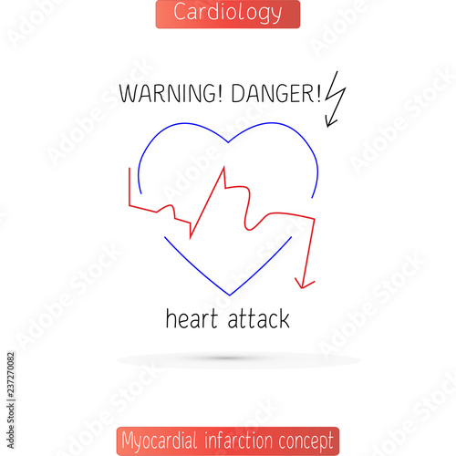 The heart with ECG line in form of light. Concept vector illustration of myocardial infarction.