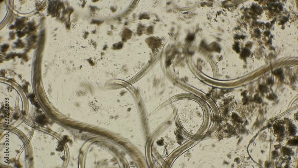 vid-o-stock-nematode-worm-colony-which-is-used-to-feed-fish-fry-under
