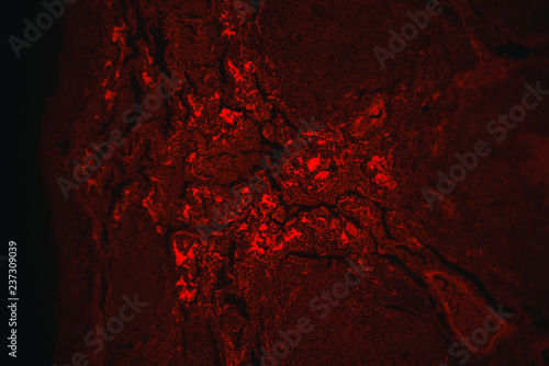 tuberculoid granuloma of hunman