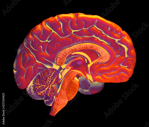 Wallpaper Mural FALSE COLOUR IMAGE OF LEFT HALF OF HUMAN BRAIN ON BLACK BACKGROUND Torontodigital.ca