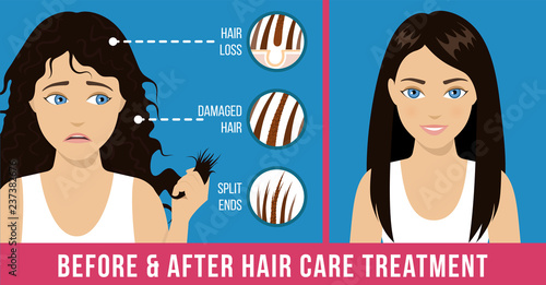 Hair care. Common problems - split ends, damaged hair, loss. Before and after hair care treatment. Vector