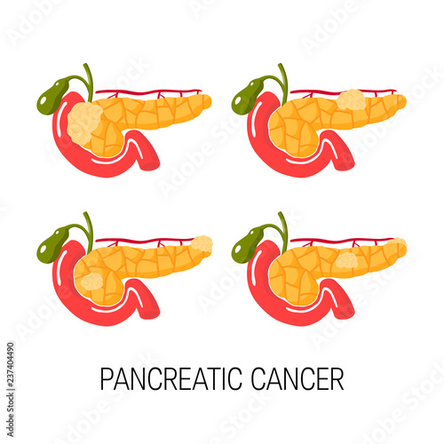 Healthy pancreas concept. Vector illustration