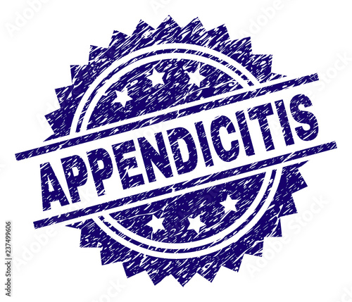 APPENDICITIS stamp seal watermark with distress style. Blue vector rubber print of APPENDICITIS title with unclean texture.