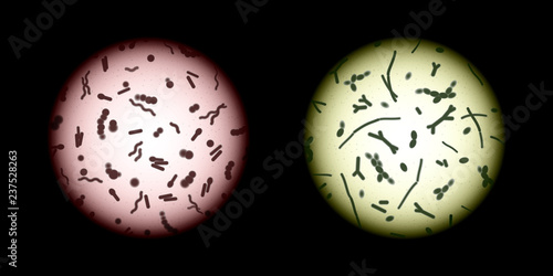 Human microbiota samples under a microscope, pathogenic and symbiotic microorganisms or good and bad bacteria abstract concept vector, various stained bacteria cells in a microscope field of view