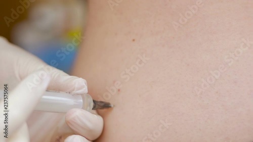 Close-up of the hand of a medic administering an intramuscular injection to a patient.