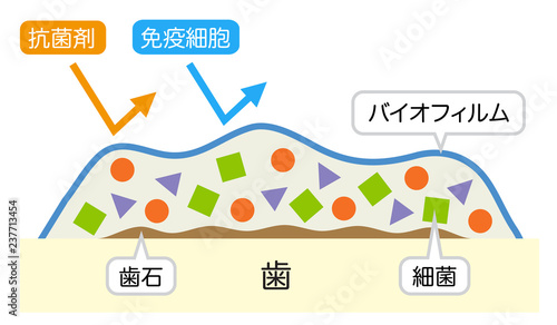 バイオフィルム　歯