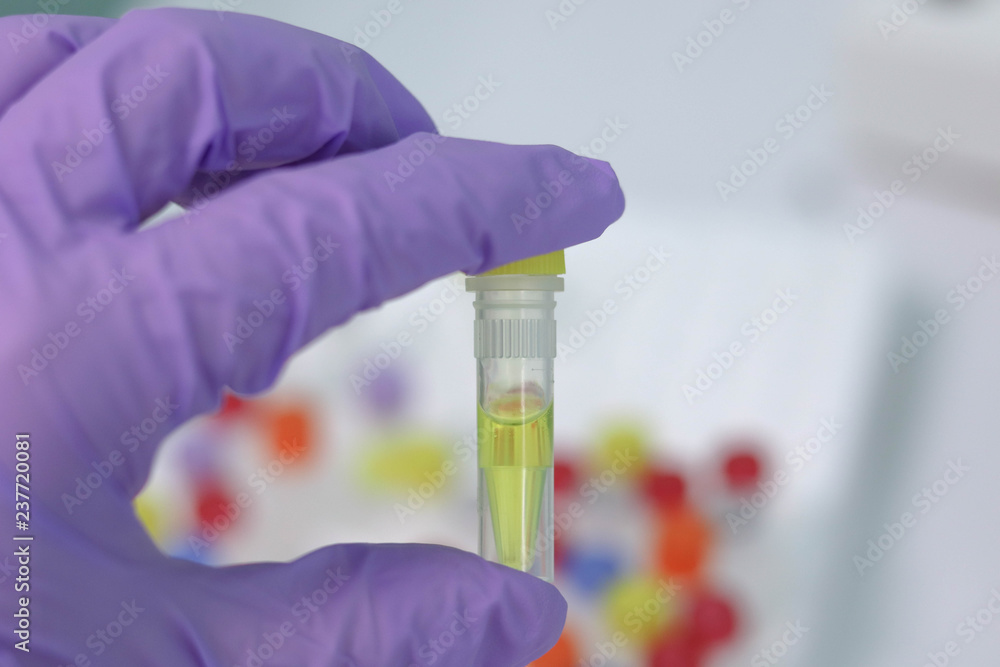 Tubes in the PCR laboratory. In vitro reagents for PCR analysis for