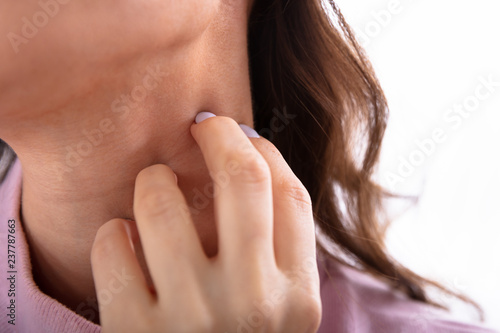Woman Scratching Her Neck