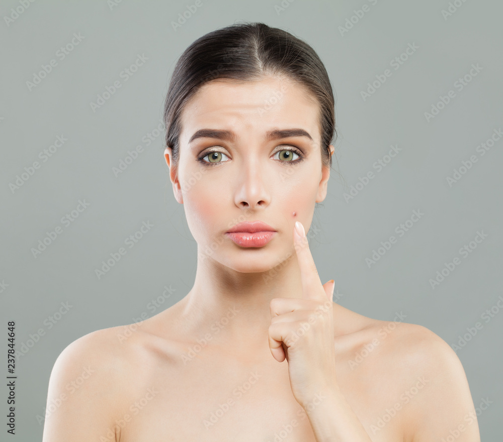 Young woman with acne pimple. Female skin problem. Facial treatment, cosmetology and skincare concept Young woman with acne pimple. Female skin problem. Facial treatment, cosmetology and skincare concept