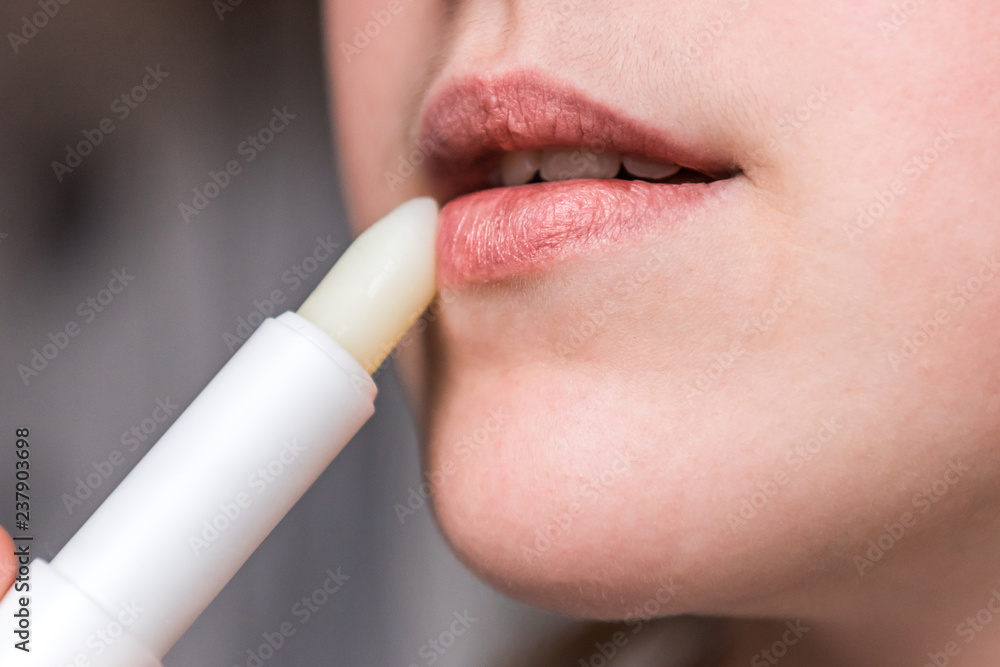 Naklejka premium Chapped, or cracked, dry lips that have lost moisture. Woman maintains her lips. Lip Care. 