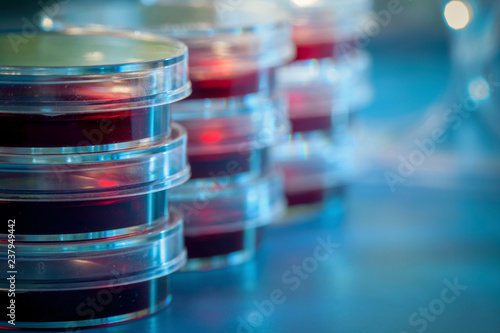 Petri dishes in microbiology lab photo