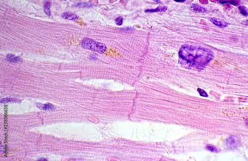 Cardiac myocytes. Lipofuscin