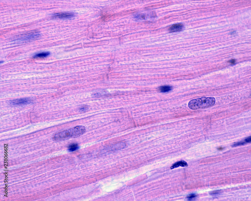 Myocardium. Striated muscle fibers
