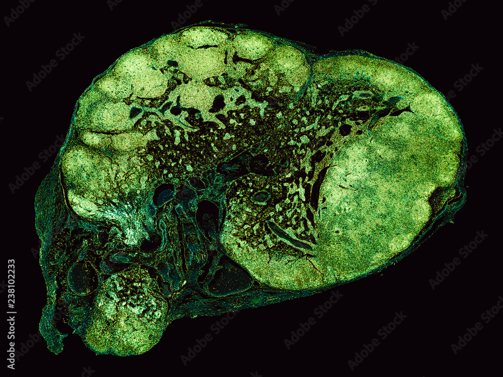 lymphonodus cross section cut under the microscope microscopic view