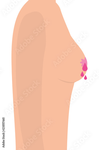 Breast cancer sign