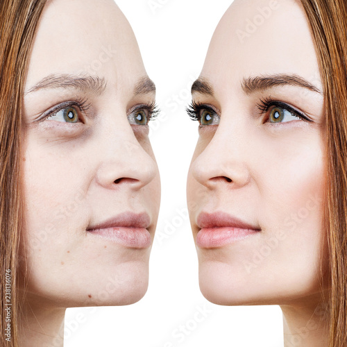 Young woman before and after makeup on face.
